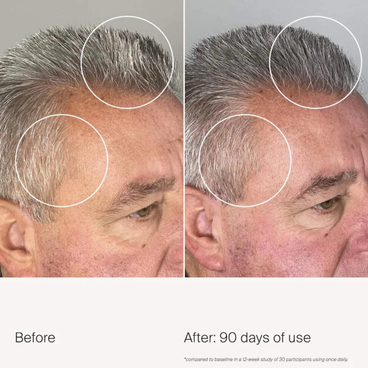 Sérum densifiant scalp care density - 50 ML